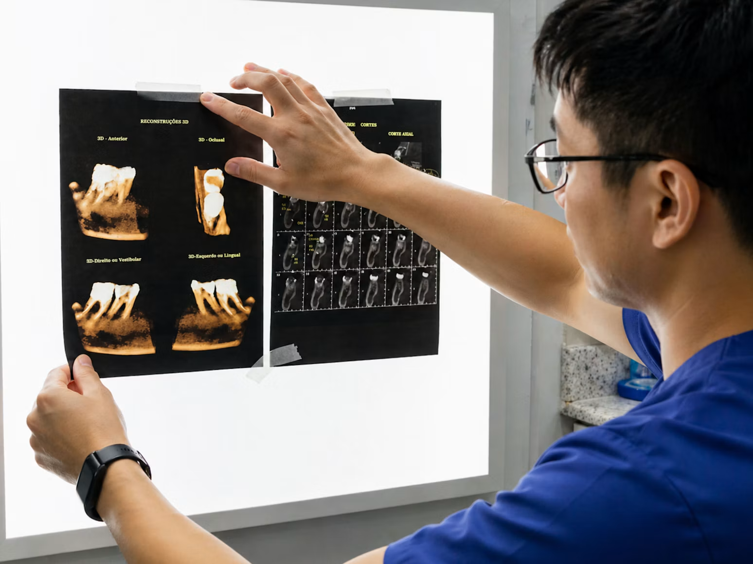 牙齒矯正為什麼要拍X光?全景X光、側顱X光、口掃分別看什麼? 牙齒矯正為什麼要拍X光?全景X光、側顱X光、口掃分別看什麼?